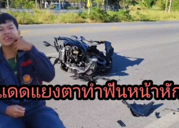 ระยอง แดดแยงตา ทำฟันหน้าหัก
