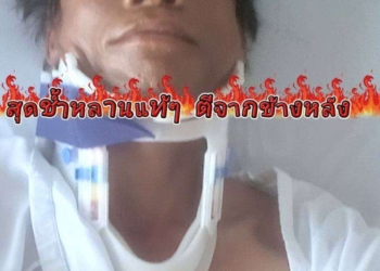 ย่าสุดช้ำลูกถูกหลานตีสลบ