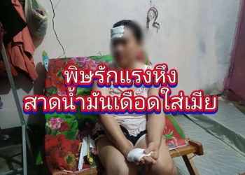 ระยอง พิษรักแรงหึงสาดน้ำมันเดือดใส่เมีย