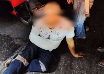 ระยอง เก๋งโหดฟันพ่วงแขนหวิดขาด