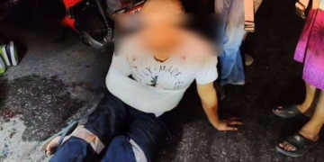 ระยอง เก๋งโหดฟันพ่วงแขนหวิดขาด