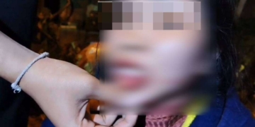 ระยอง ชนสนั่นไม่อยากไปโรงบาล