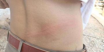 ระยอง แม่ระยองเดือดครูตีมาราธอน