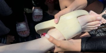 ระยอง รองเท้ากินขาระบาดหนัก